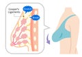 Diagram of sagging breasts and womanÃ¢â¬â¢s body illustration. beauty body and health care concept